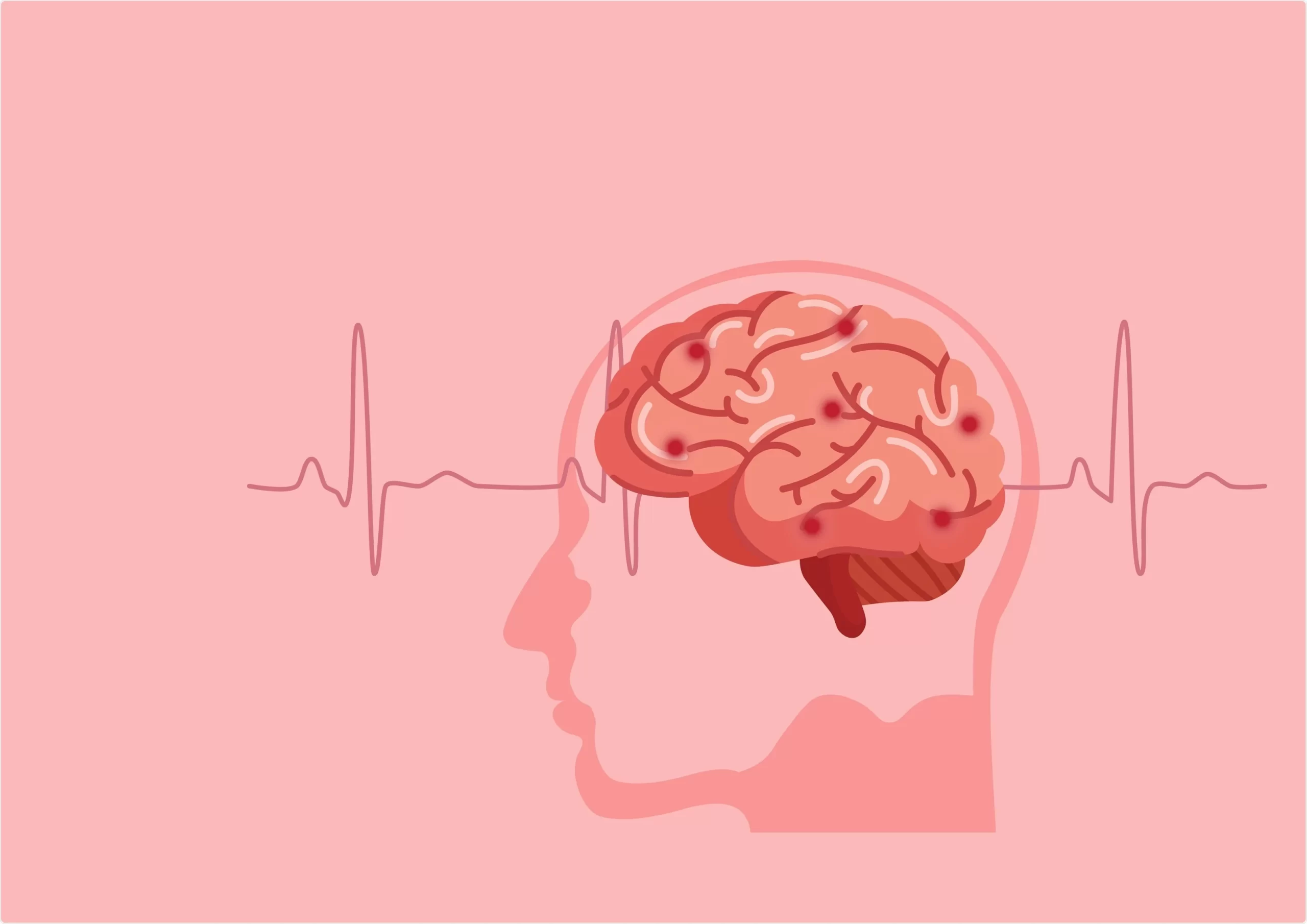 how to prevent brain aneurysm