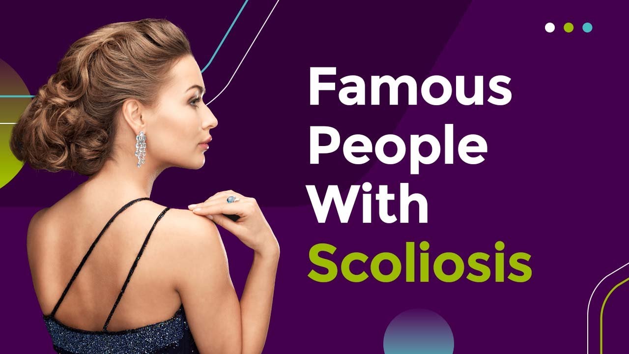 famous people with scoliosis